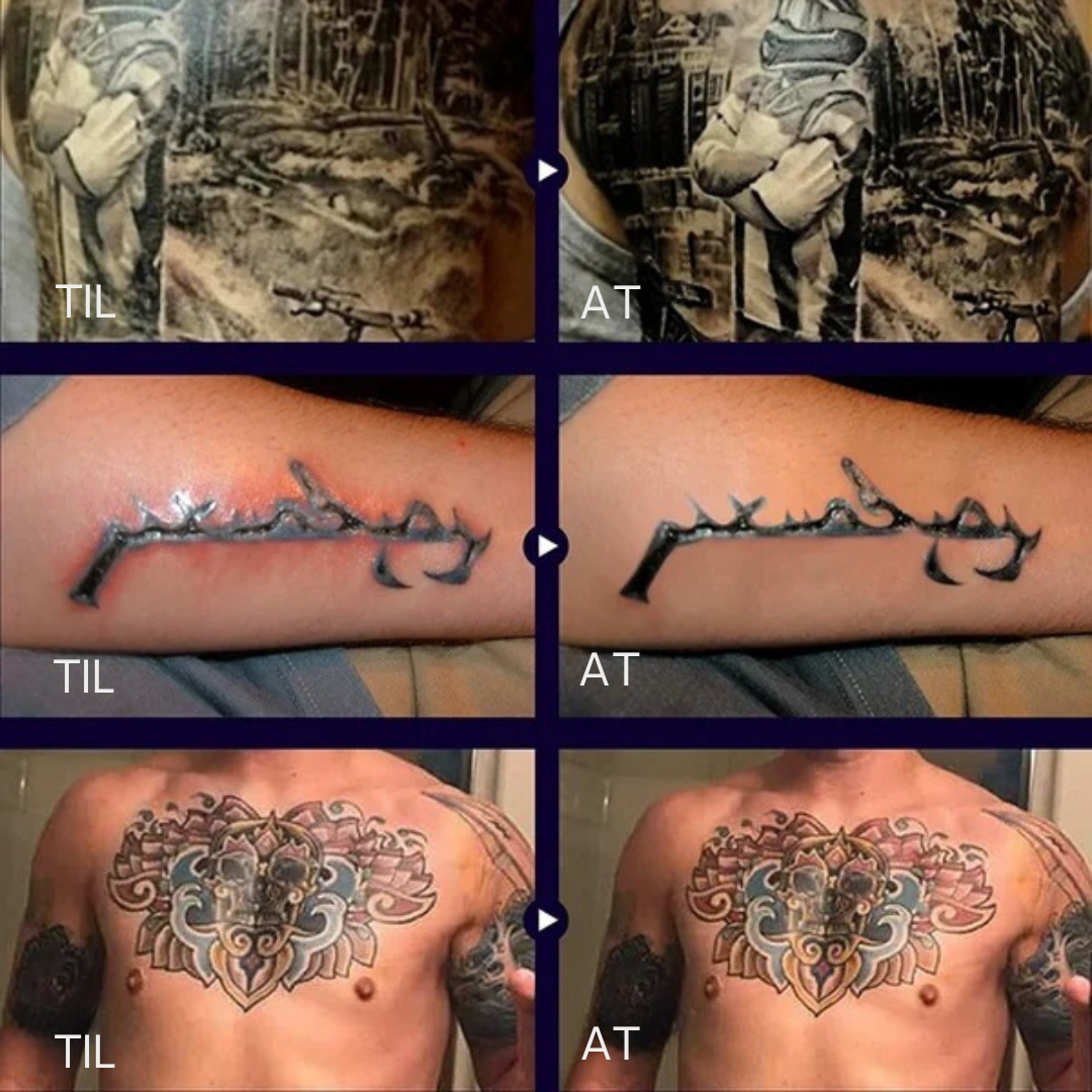 InkGlow™ | Tatovering lysnende balsam